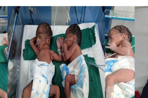 पोखराको मणिपाल अस्पतालमा चम्ल्याहा शिशुको जन्म