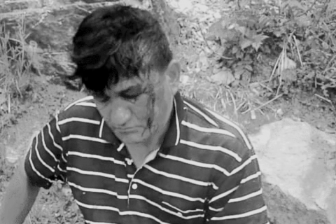 आँबुखैरेनीमा रुखबाट लडेर एक पुरुष गम्भीर घाइते