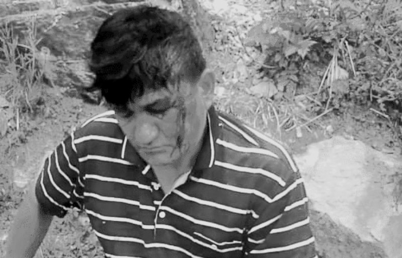 आँबुखैरेनीमा रुखबाट लडेर एक पुरुष गम्भीर घाइते