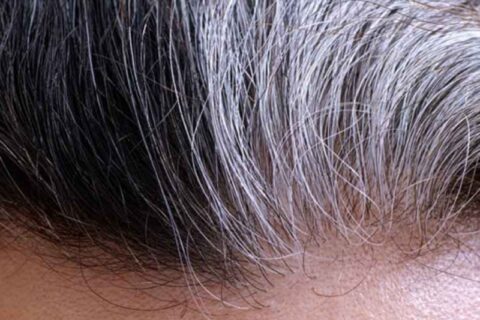 सानै उमेरमा किन फुल्छ कपाल ?