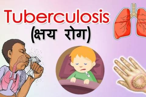 गोरखामा आठ महिनामा १३३ जनामा क्षयरोग सङ्क्रमण