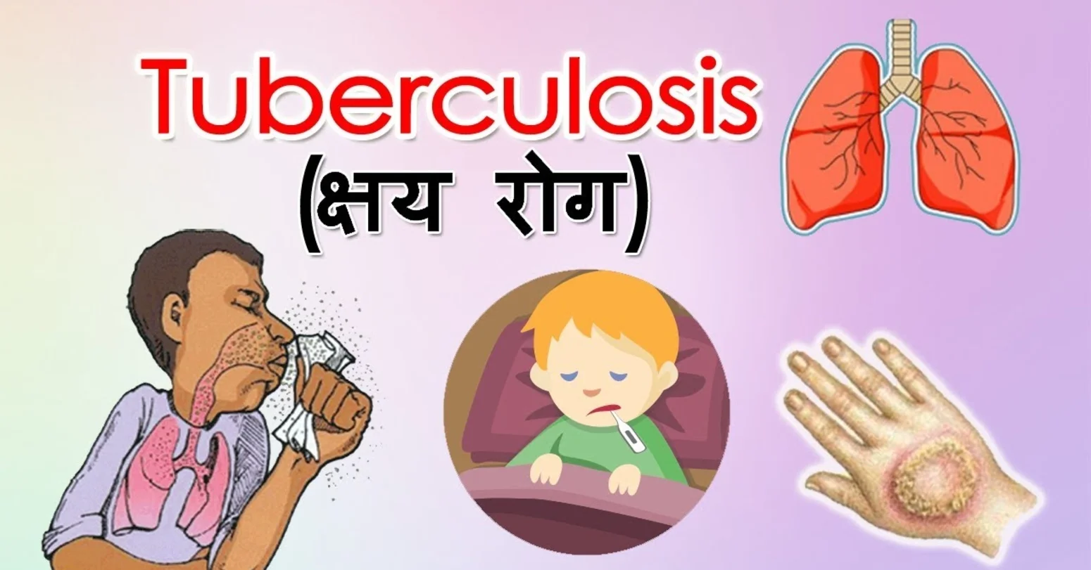 गोरखामा आठ महिनामा १३३ जनामा क्षयरोग सङ्क्रमण